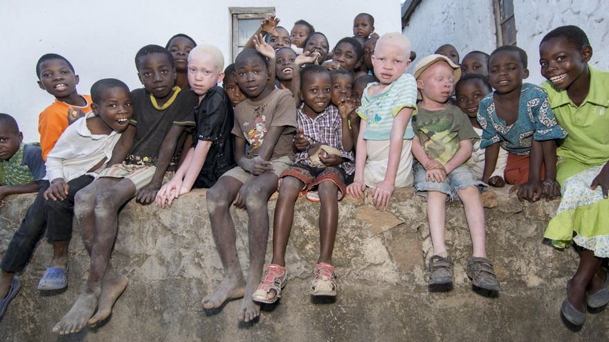 Uno de los países que ha visto como aumentaba el número de albinos asesinados ha sido Malawi