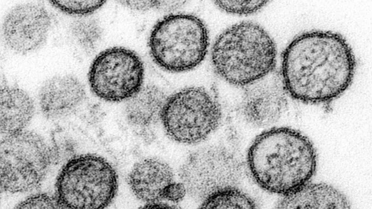 Los virólogos desmienten bulos sobre el hantavirus: ni nuevo ni es como el COVID