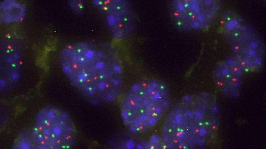 Científicos españoles descubren una proteína que actúa como barrera natural frente al cáncer de pulmón