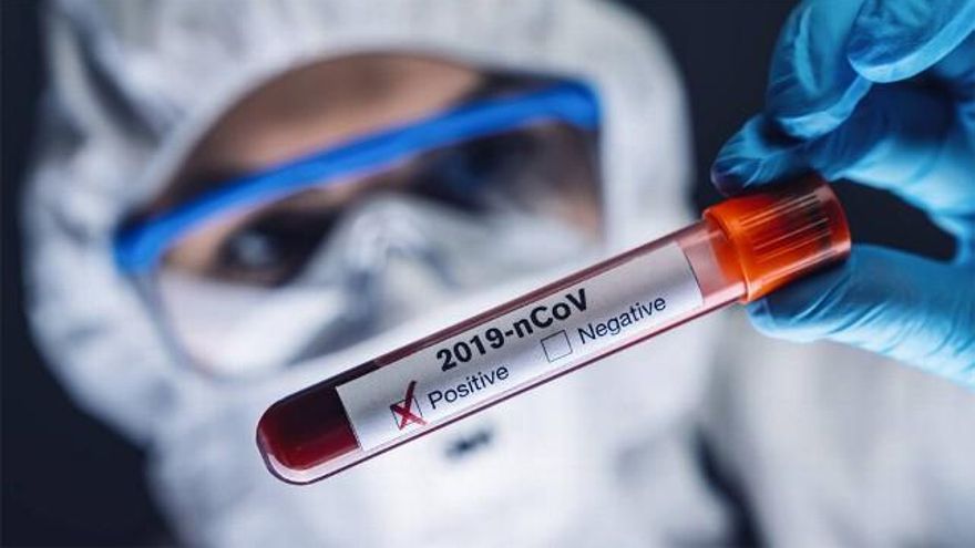 El megaensayo SOLIDARITY probará cuatro de los tratamientos más prometedores. / Adobe Stock