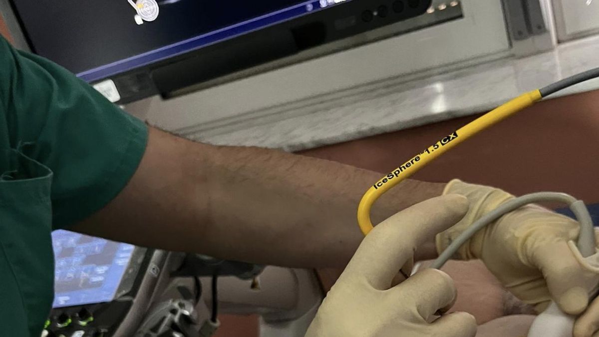 Realización de la novedosa técnica en el Hospital de La Candelaria.